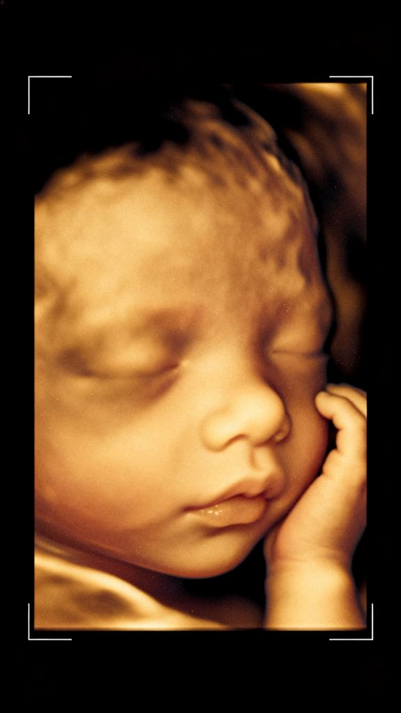 Make your little baby smile image